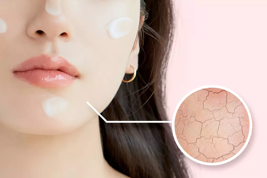 محصولات مخصوص پوست خشک