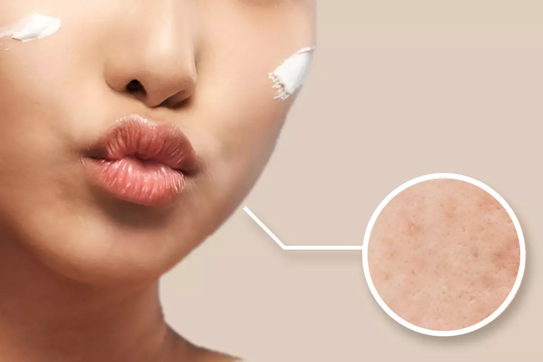 محصولات مخصوص پوست لک دار