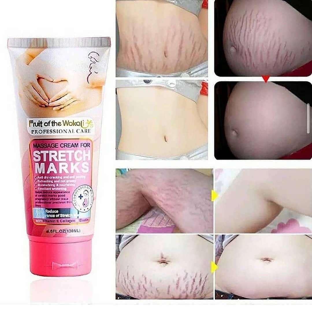 کرم ترک شکم وکالی از بین برنده ترک های پوستی