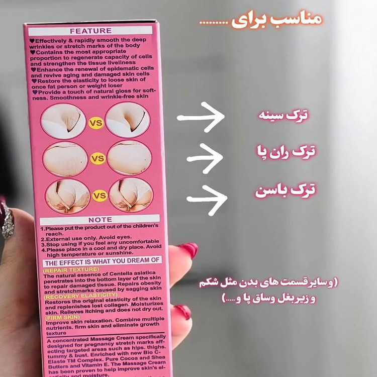 کرم ترک شکم وکالی از بین برنده ترک های پوستی