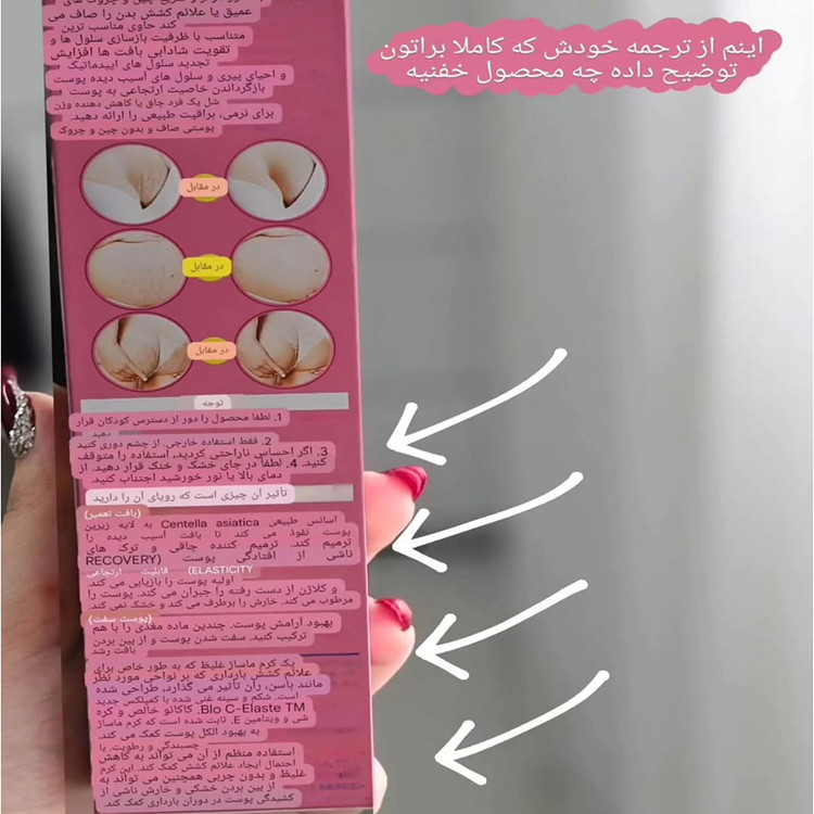 کرم ترک شکم وکالی از بین برنده ترک های پوستی
